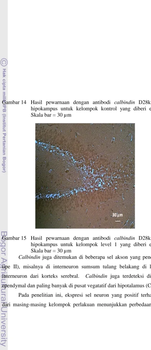 Gambar 14  Hasil pewarnaan dengan antibodi calbindin  D28k  pada bagian  hipokampus  untuk kelompok kontrol yang diberi ekstrak etanol
