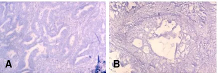 Gambar 3. A. Tampilan antibodi terhadap HPV, negatif pada adenokarsinoma (x40); B. Tampilan antibodi terhadap HPV, negatif pada karsinoma adenoskuamous (x40) 