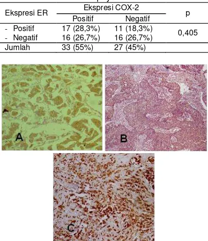 Tabel 3. Hubungan Ekspresi COX-2 dengan ER pada  invasive carcinoma NST payudara 