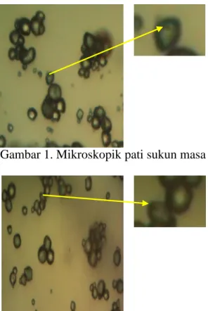 Gambar 1. Mikroskopik pati sukun masa panen 1 bulan 