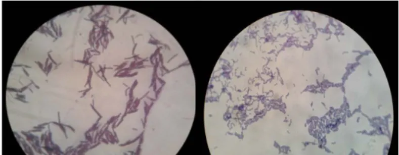 Gambar A.3. Lactobacillus delbrueckii ssp. Bulgaricus (kiri) dan  Streptococcus salivarius ssp Thermophilus (kanan)