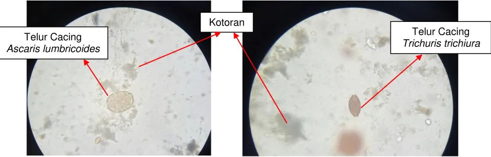 Gambar 6. A. Lapang pandang dari pewarnaan menggunakan Eosin 2% (kontrol); B. Lapang              pandang dari telur cacing tanpa pewarnaan 