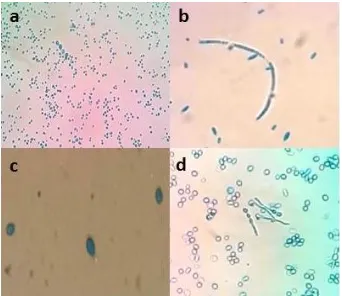 Gambar 2. Ragi dan blastospora (a), pseudohifa (b), klamidospora (c), dan  germ tubes (d)  Sumber: Data Primer (2017) 