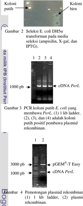 Gambar  2   Seleksi E. coli DH5α  transforman pada media  seleksi (ampisilin, X-gal, dan  IPTG).