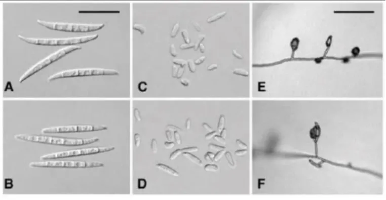 Gambar 2.1 Morfologi F.oxysporum (Damayanti, 2009) 