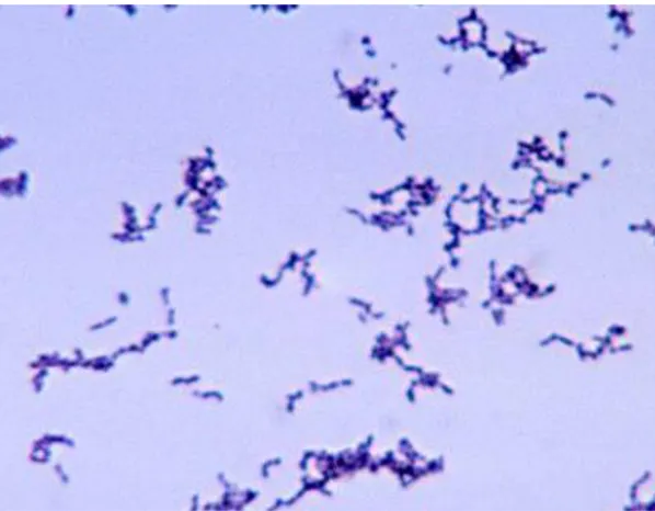 Gambar 1. Bakteri Propionibacterium acne (Perbesaran: 1000X) 