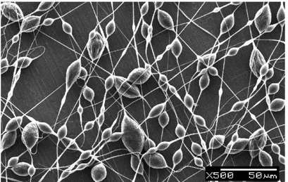 Gambar 2.5. Beads nanofiber (Qin, 2008) 