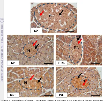Gambar 5 Fotomikrograf pulau Langerhans jaringan pankreas tikus percobaan dengan pewarnaan  imunohistokimia terhadap antioksidan Cu,Zn-SOD