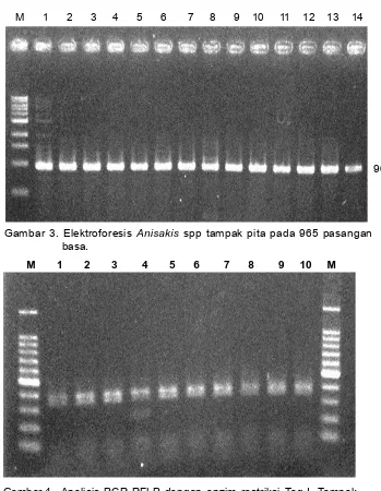 Gambar 4.  Analisis PCR-RFLP dengan enzim restriksi Taq I. Tampak adanya 2 buah pita, pita atas terbaca pada angka 400 bp dan pita bawah terbaca pada angka 350 bp