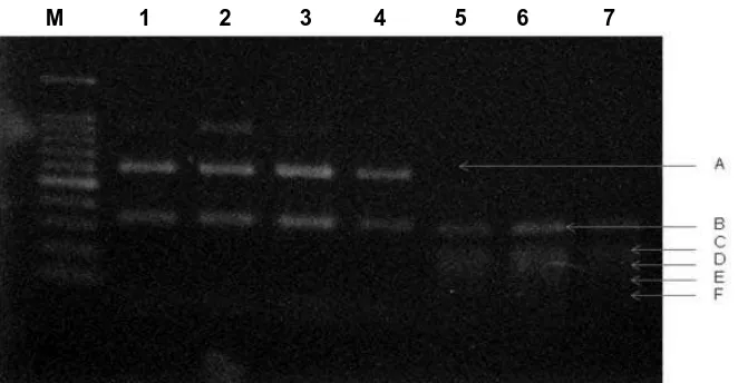 Gambar 5. Uji PCR-RFLP menggunakan enzim restriksi Hinf I dan Cfo I. M= marker, Lane 1 sd 4 Hinf I., Lane 5 sd 7 dengan Cfo I