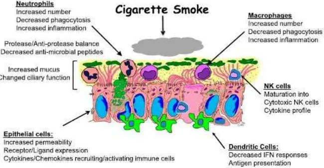 Gambar 3 . pengaruh asap rokok terhadap mukosa hidung18 