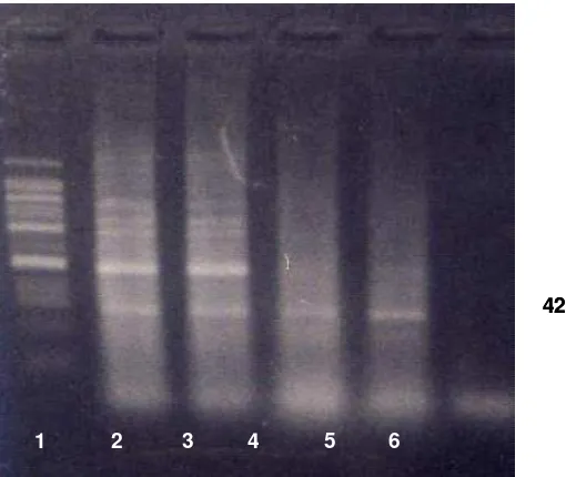 Gambar 5. Hasil deteksi VNN dengan PCR setelah uji tantang dengan VNN pada benih ikan kerapu bebek, Cromileptes altivelis yang ditingkatkan respon imun non-spesifiknya dengan pemberian bakterin (1 = marker; 2 = perlakuan A; 3 = perlakuan B; 4 = perlakuan C