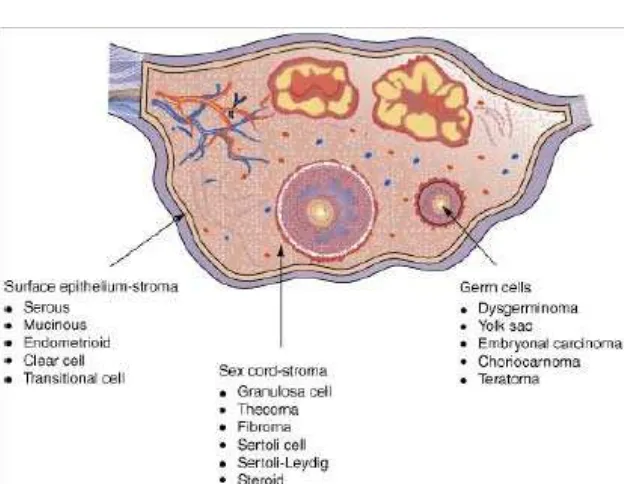 Gambar 2.1. Asal mula dari tiga tipe utama kanker ovarium.1