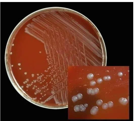 Gambar 4. Kultur bakteri Neisseria gonorrhoeae20