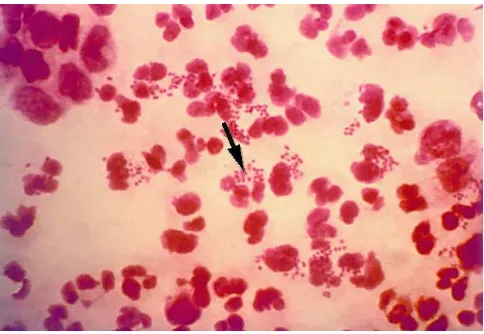 Gambar 1. Bakteri Neisseria gonorrhoeae6 