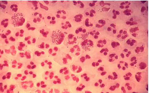Gambar 3. Pengecatan gram Neisseria gonorhoeae16