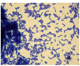 Gambar 1. Streptococcus mutans13. 