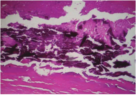 Gambar 1. Jaringan ikat kolagen bagian luar tidak mengalami nekrosis