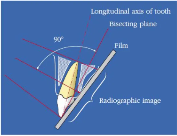 Gambar  2.4.  Bisecting  angle  technique  (Teknik  membagi  dua  sudut)  (Sumber:  Castellucci,  2004: 80) 