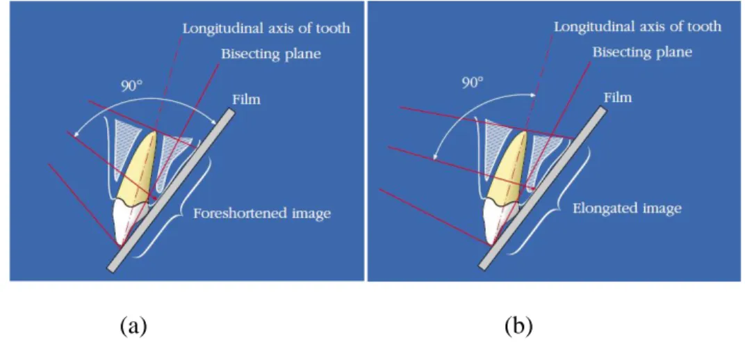 Gambar  2.5.  (a)  Jika  sinar  X-ray  berorientasi  tegak  lurus  terhadap  bidang  film,  gambar  radiografi  akan  memendek