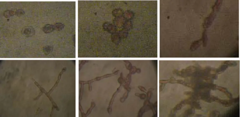 Gambar 4. Perkembangan protoplas dari rumput laut Kappaphycus alvarezii hasil fusi yang dikultur pada media semi solid yang diperkaya dengan IAA 0,4 mg/L