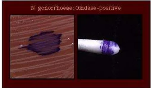 Gambar 3. Oksidase Positif pada Neisseria gonorrhoeae24