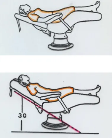 Gambar menunjukkan posisi  pasien pada perawatan  kwandran kiri dan kanan  rahang atas yang berbaring  sehorizontal mungkin 
