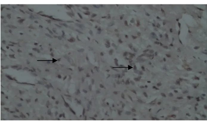 Gambar 4.4.1. Intensitas Pewarnaan ER-β 1+ (Inti sel yang mengandung  reseptor ER-β dengan intensitas lemah (tanda panah))