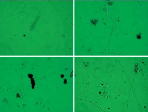 Figure 4. Phase contrast microscopy images of airborne crocidolite asbestos fibers collected at an asbestos cement plant