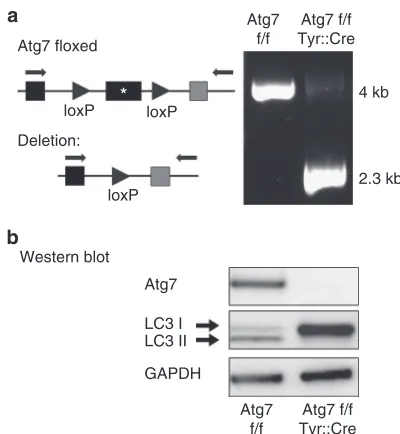 Figure 1. Autophagy is constitutively active in normal human and murinemelanocyte (MC)