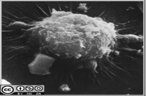 Gambar  3.  A  dust  particle  to  be  phagocytosed  by  an  alveolar  macrophage  6 