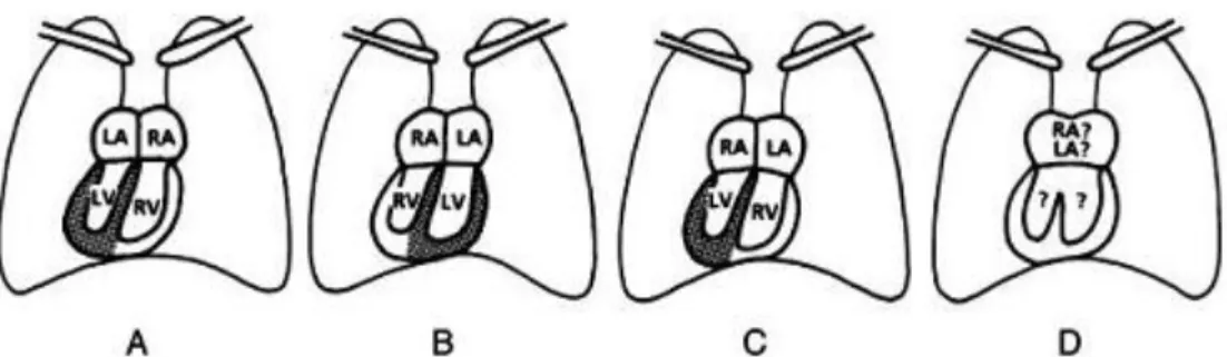 Gambar 1. Gambaran kondisi umum dimana apex dari jantung berada pada dada sebelah kanan