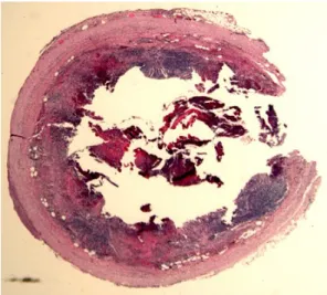 Gambar 2. Potongan transversa Appendix  5