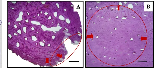 Gambar 9  Gambaran mikroskopis persembuhan tulang kontrol pada hari ke-60  pascaoperasi, terbentuk tulang kompakta dengan struktur osteon  (lingkaran merah), saluran Haver’s (H), saluran Volkmann (V), dan  osteosit (OS)