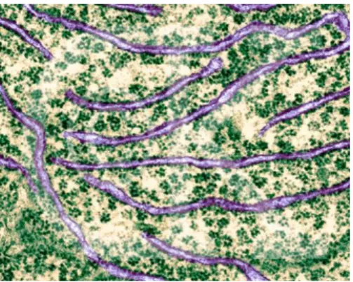 Gambar 8. Retikulum endoplasma kasar dengan ribosom 