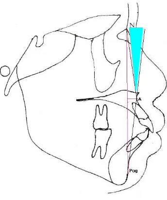 Gambar 6. Pengukuran sudut NAPog (daerah warna biru)      Pengukuran jarak A-Npog (Garis merah)  