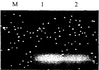 Gambar 4. Hasil PCR Optimalisasi Suhu Primer HSP 01 