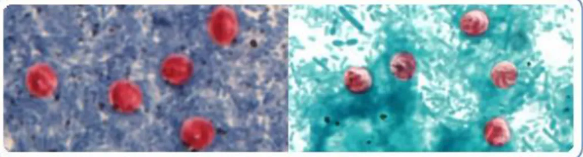 Gambar 3. kiri: Oocyts Cryptosporidium sp dengan pewarnaan  Ziehl-Neelson modifikasi                    acid-fast