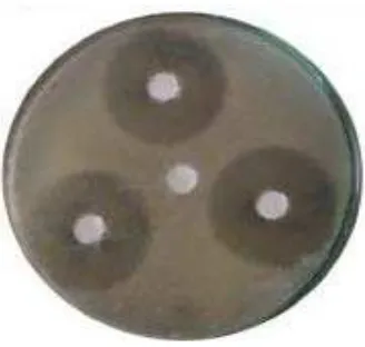 Gambar 2.4 Tes Kirby & Bauer (disk-diffusion agar method) terhadap bakteri 
