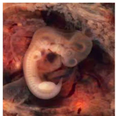 Gambar 3. 14 Malformasi Tubuh           Gambar 3.15 Kematian neonatal       ( Sumber :  yorijuly14.wordpress.com )        ( Sumber: zidanedailiblog.blogspot.com )