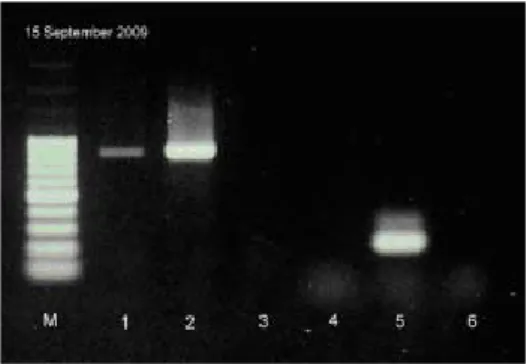 Gambar 2.  Hasil analisis PCR dari  isolate MT1