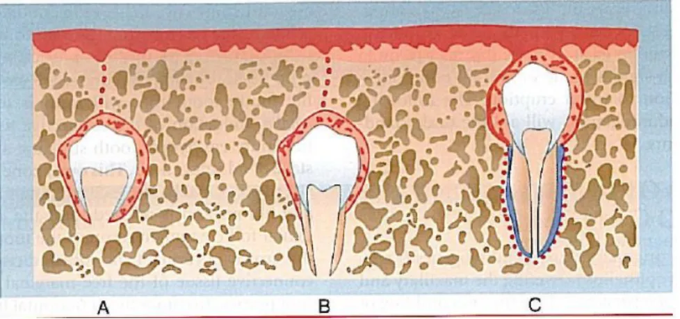 Gambar  2 Later  Stages of Odontogenesis A. Pembentukan mahkota dan lamina  dental B. Pembentukan Akar  C