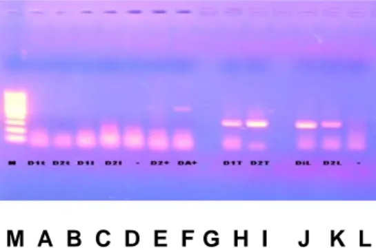 Gambar 5. Hasil diagnosa dengan teknik Polymerase Chain Reaction (PCR) sampel isolat bakteri dari ikan gurame uji yang diinfeksi Mycobacterium Step 1
