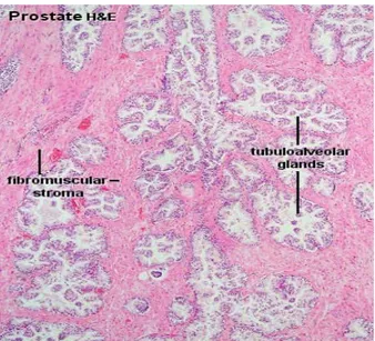 Gambar 2.2. Histologi Kelenjar Prostat Normal   (School of Anatomy and Human Biology, 2009)  2.3