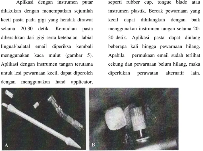 Gambar  4.  A.  Instrumen  putar  dan  instrumen  tangan  untuk  aplikasi  bahan  pada  teknik  mikroabrasi Email, B