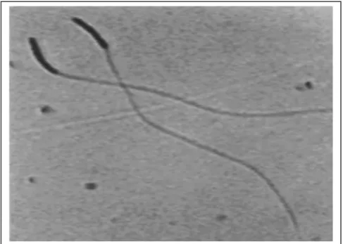 Gambar 1. Bentuk morfologi spermatozoa unggas yang normal (pembesaran 400x)  Sumber: S ONTAKKE  et al