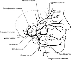 Gambar 1. Kelenjar ludah parotis dan percabangan nervus fasialis. 10 