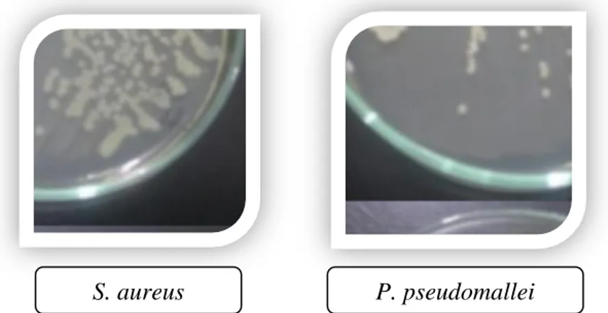 Gambar  biakan  masing-masing  isolat  bakteri  pada  medium  lempeng,  yang  dibuat  dengan menggunakan metode garis zig-zag tersaji pada Gambar 2