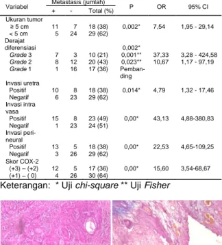 Gambar  1.  A.  KSS  grade  2;  B.  Invasi  uretra  positif  (HE, 400x). 