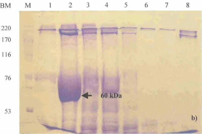 Gambar 4.2 Profil protein larva C. pavonana instar 4 yang diberi perlakuan rokaglamida dan pemarasitan oleh E